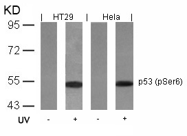Rabbit Polyclonal Antibody to p53(Phospho-Ser6)