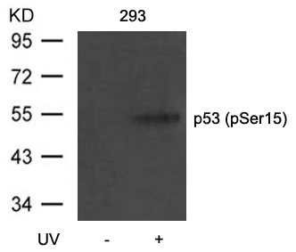 Rabbit Polyclonal Antibody to p53(Phospho-Ser15)