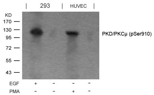Rabbit Polyclonal Antibody to PKD/PKCm(Phospho-Ser910)