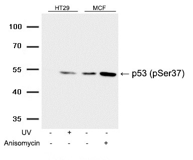 Rabbit Polyclonal Antibody to p53(Phospho-Ser37)