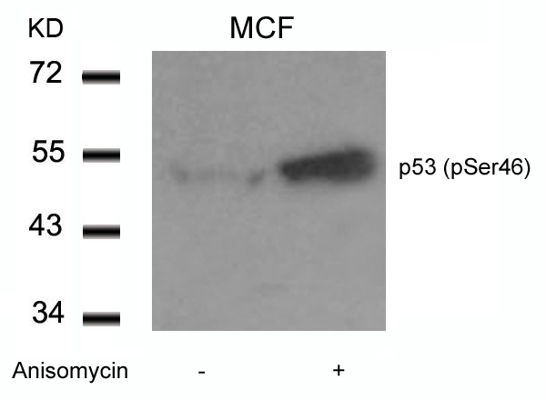 Rabbit Polyclonal Antibody to p53(Phospho-Ser46)