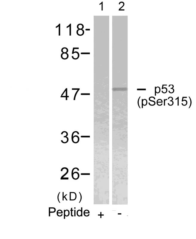 Rabbit Polyclonal Antibody to p53(Phospho-Ser315)