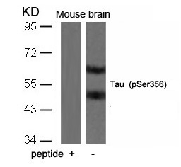 Rabbit Polyclonal Antibody to Tau(Phospho-Ser356)