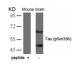 Rabbit Polyclonal Antibody to Tau(Phospho-Ser396)