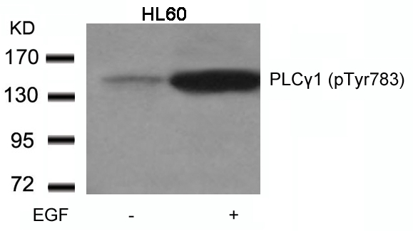 Rabbit Polyclonal Antibody to PLCgamma1(Phospho-Tyr783)