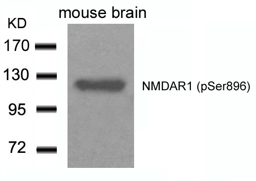 Rabbit Polyclonal Antibody to NMDAR1(Phospho-Ser896)