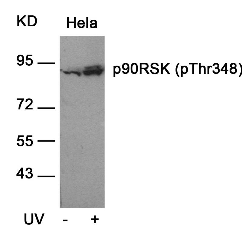 Rabbit Polyclonal Antibody to p90RSK(Phospho-Thr348)