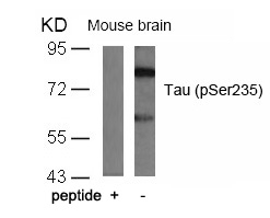 Rabbit Polyclonal Antibody to Tau(Phospho-Ser235)
