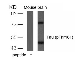 Rabbit Polyclonal Antibody to Tau(Phospho-Thr181)