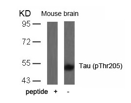 Rabbit Polyclonal Antibody to Tau(Phospho-Thr205)