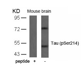 Rabbit Polyclonal Antibody to Tau(Phospho-Ser214)
