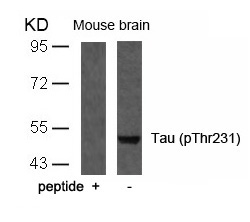 Rabbit Polyclonal Antibody to Tau(Phospho-Thr231)