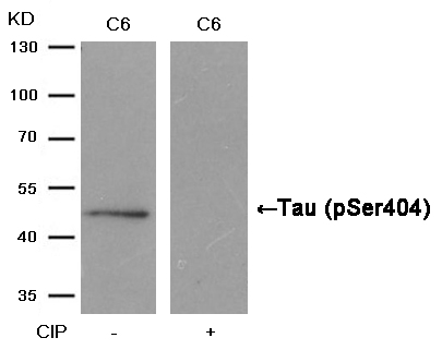 Rabbit Polyclonal Antibody to Tau(Phospho-Ser404)