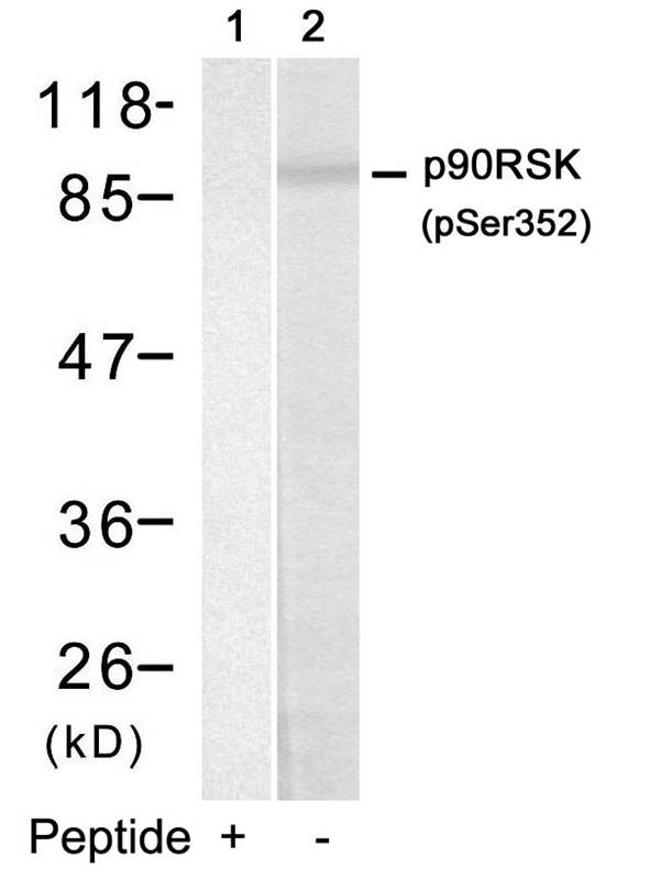 Rabbit Polyclonal Antibody to p90RSK(Phospho-Ser352)