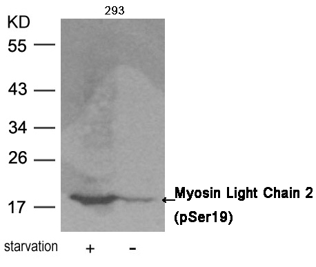 Rabbit Polyclonal Antibody to Myosin Light Chain 2 (Phospho-Ser19)