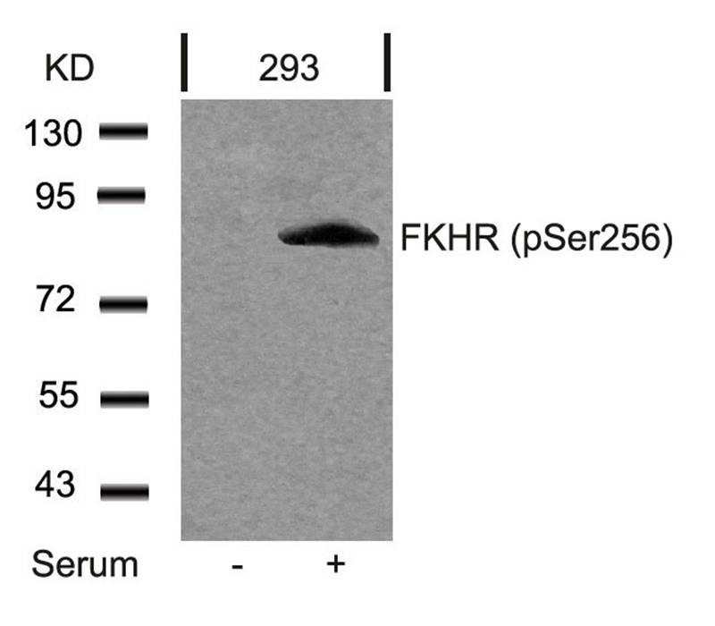Rabbit Polyclonal Antibody to FKHR(Phospho-Ser256)