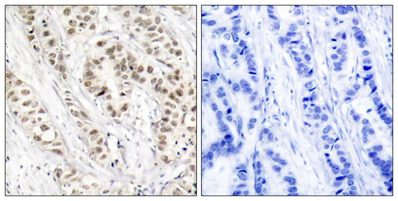 Rabbit Polyclonal Antibody to BRCA1(Phospho-Ser1524)