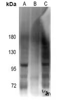Rabbit Polyclonal Antibody to Androgen Receptor(Phospho-Ser213)