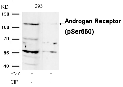 Rabbit Polyclonal Antibody to Androgen Receptor(Phospho-Ser650)