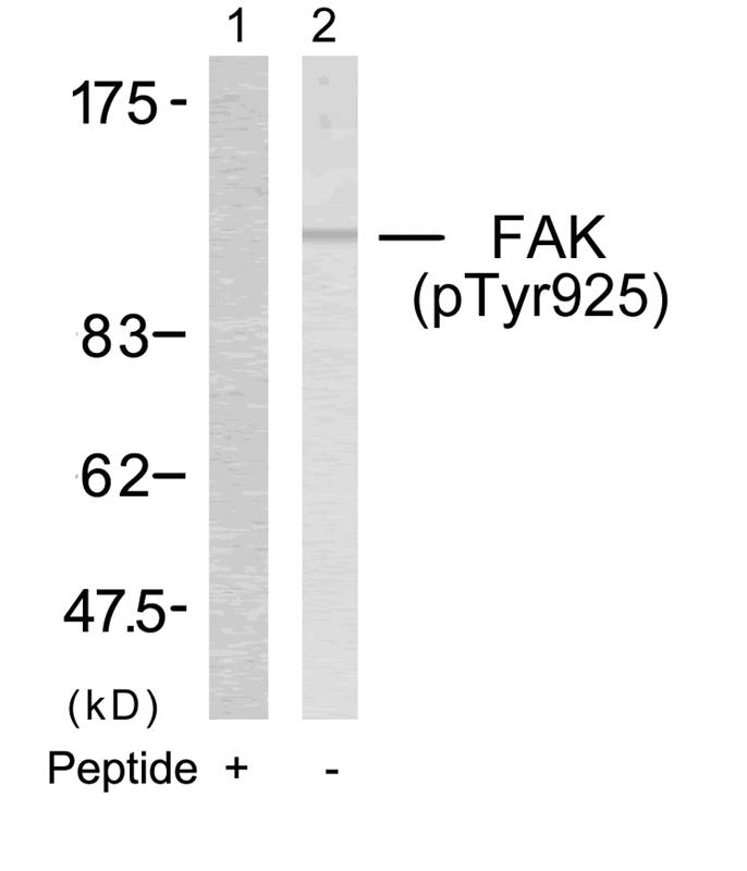Rabbit Polyclonal Antibody to FAK(Phospho-Tyr925)
