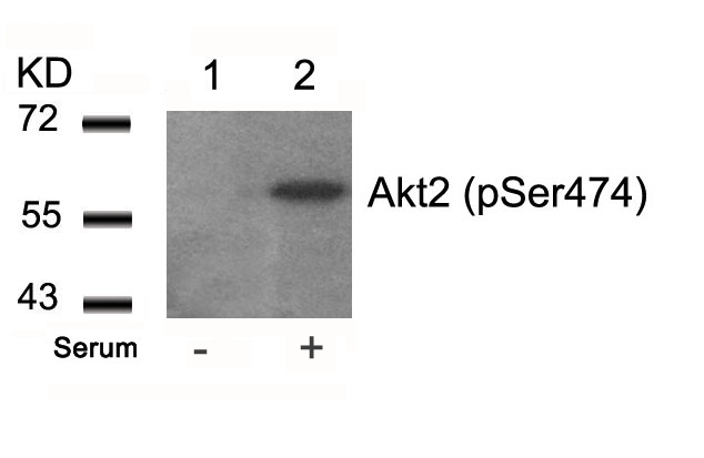 Rabbit Polyclonal Antibody to Akt2(Phospho-Ser474)