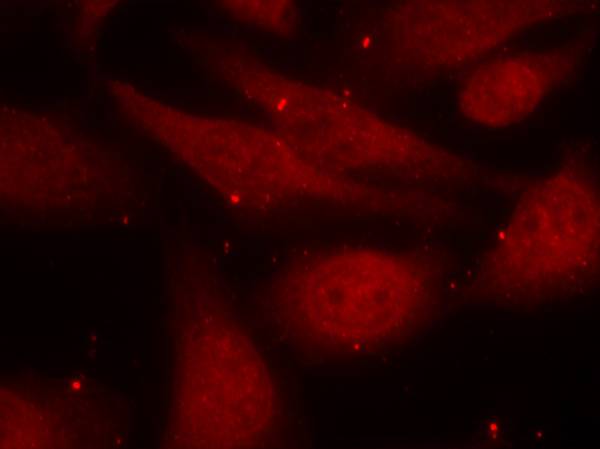 Rabbit Polyclonal Antibody to c-Abl(Phospho-Tyr412)