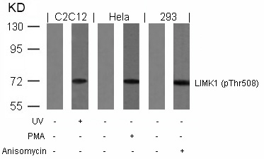 Rabbit Polyclonal Antibody to LIMK1(Phospho-Thr508)