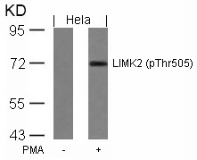 Rabbit Polyclonal Antibody to LIMK2(Phospho-Thr505)