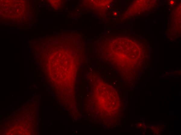 Rabbit Polyclonal Antibody to HDAC8(Phospho-Ser39)