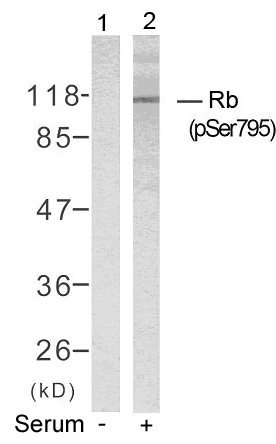 Rabbit Polyclonal Antibody to Rb(Phospho-Ser795)