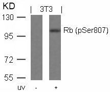 Rabbit Polyclonal Antibody to Rb(Phospho-Ser807)