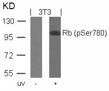 Rabbit Polyclonal Antibody to Rb(Phospho-Ser780)
