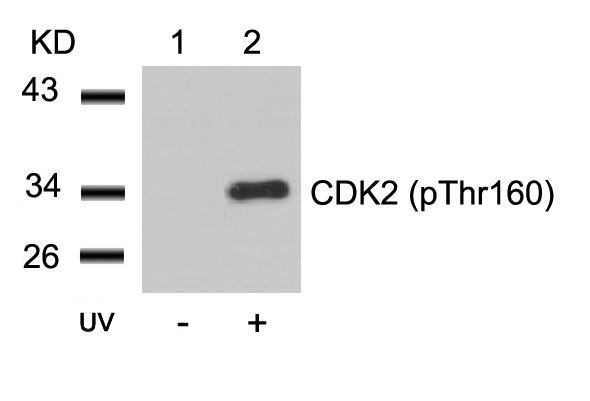 Rabbit Polyclonal Antibody to CDK2(Phospho-Thr160)