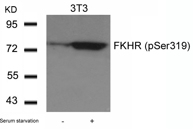 Rabbit Polyclonal Antibody to FKHR(Phospho-Ser319)