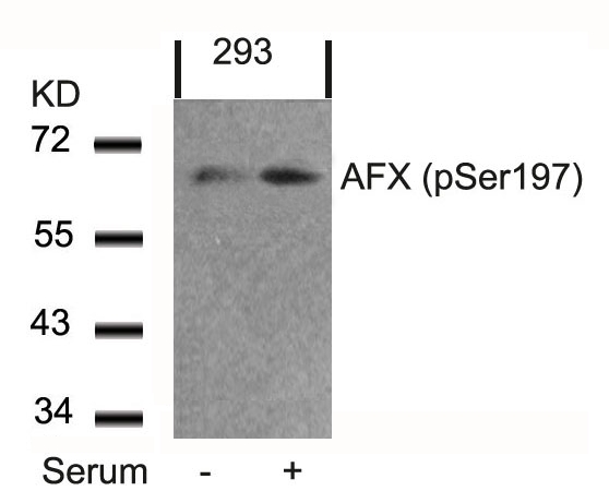 Rabbit Polyclonal Antibody to AFX(Phospho-Ser197)