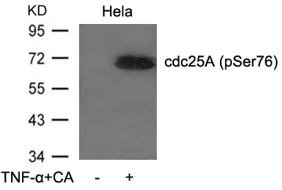 Rabbit Polyclonal Antibody to cdc25A(Phospho-Ser76)