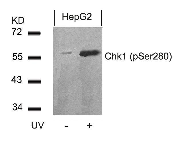Rabbit Polyclonal Antibody to Chk1(Phospho-Ser280)
