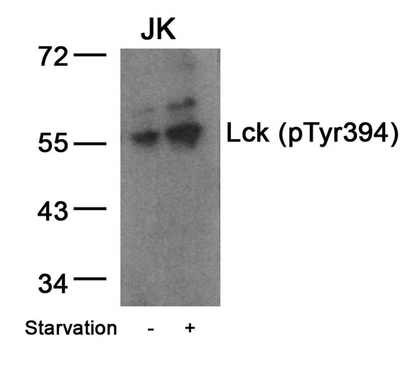 Rabbit Polyclonal Antibody to Lck(Phospho-Tyr394)