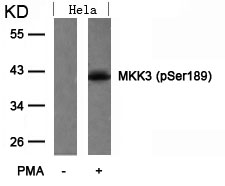 Rabbit Polyclonal Antibody to MKK3(Phospho-Ser189)