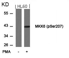 Rabbit Polyclonal Antibody to MKK6(Phospho-Ser207)