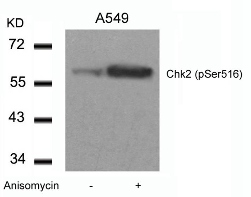 Rabbit Polyclonal Antibody to Chk2(Phospho-Ser516)