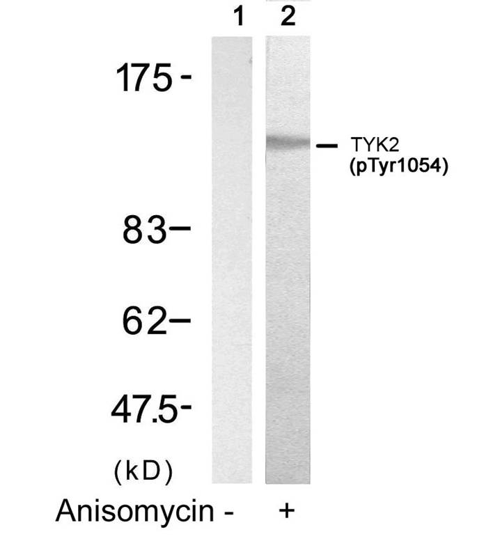 Rabbit Polyclonal Antibody to TYK2(Phospho-Tyr1054)