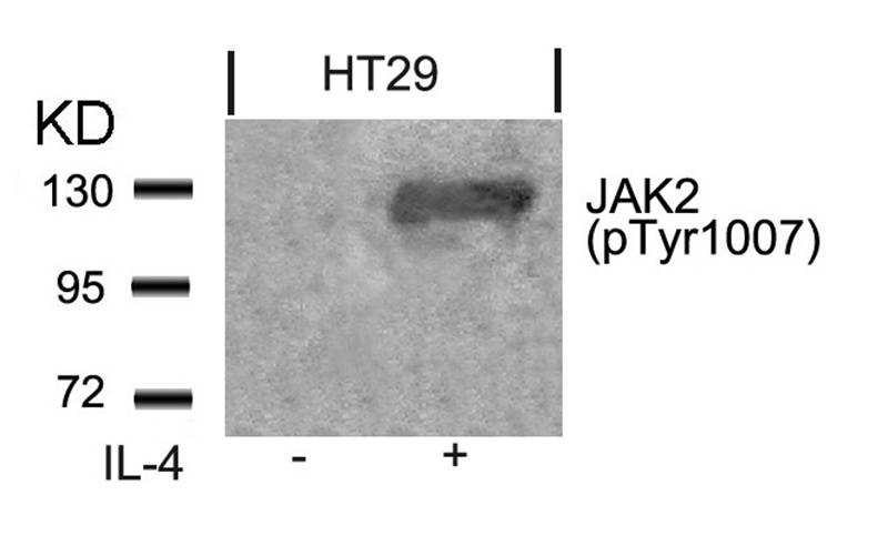 Rabbit Polyclonal Antibody to Jak2(Phospho-Tyr1007)