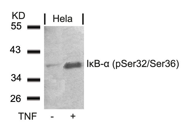 Rabbit Polyclonal Antibody to IkB-a(Phospho-Ser32/Ser36)