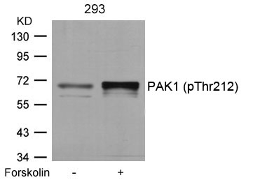 Rabbit Polyclonal Antibody to PAK1(Phospho-Thr212)