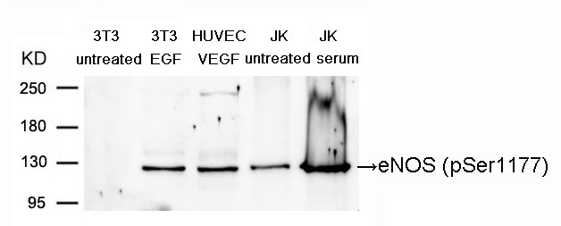 Rabbit Polyclonal Antibody to eNOS(Phospho-Ser1177)