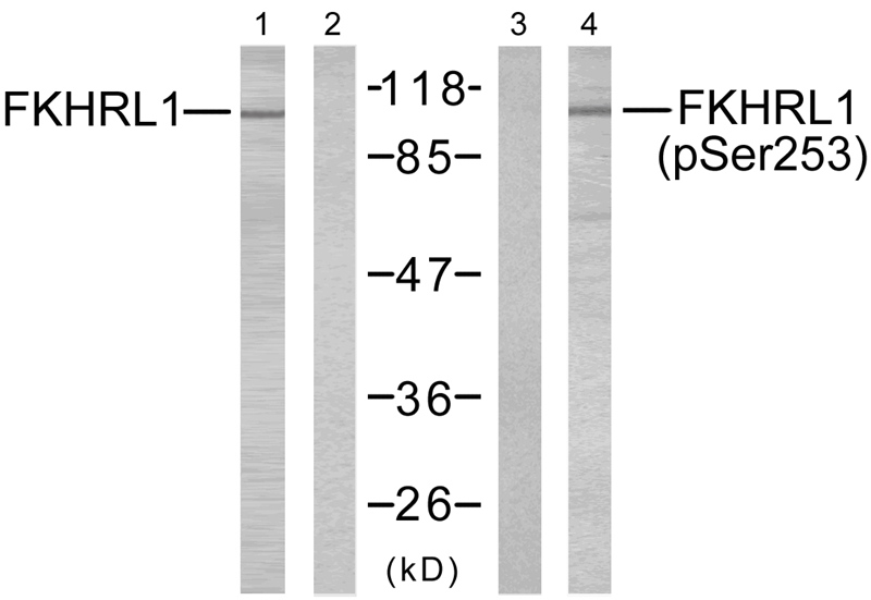 Rabbit Polyclonal Antibody to FKHRL1(Phospho-Ser253)