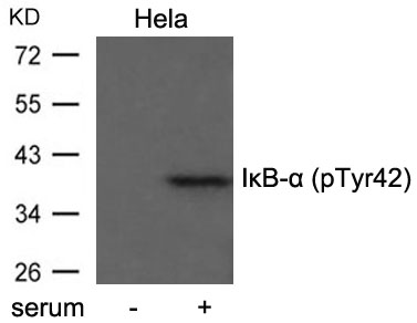 Rabbit Polyclonal Antibody to IkB-a(Phospho-Tyr42)
