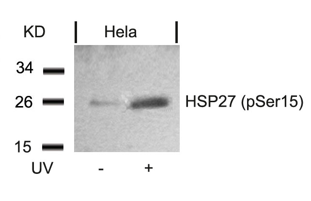 Rabbit Polyclonal Antibody to HSP27(Phospho-Ser15)