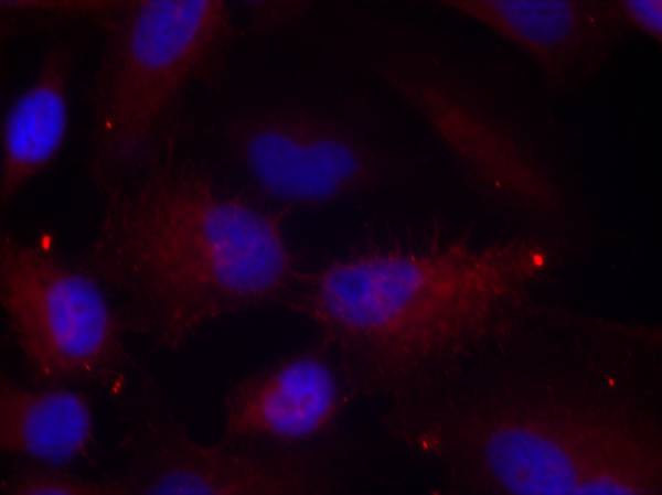 Rabbit Polyclonal Antibody to PAK1/PAK2/PAK3(Phospho-Thr423/Thr402/Thr421)